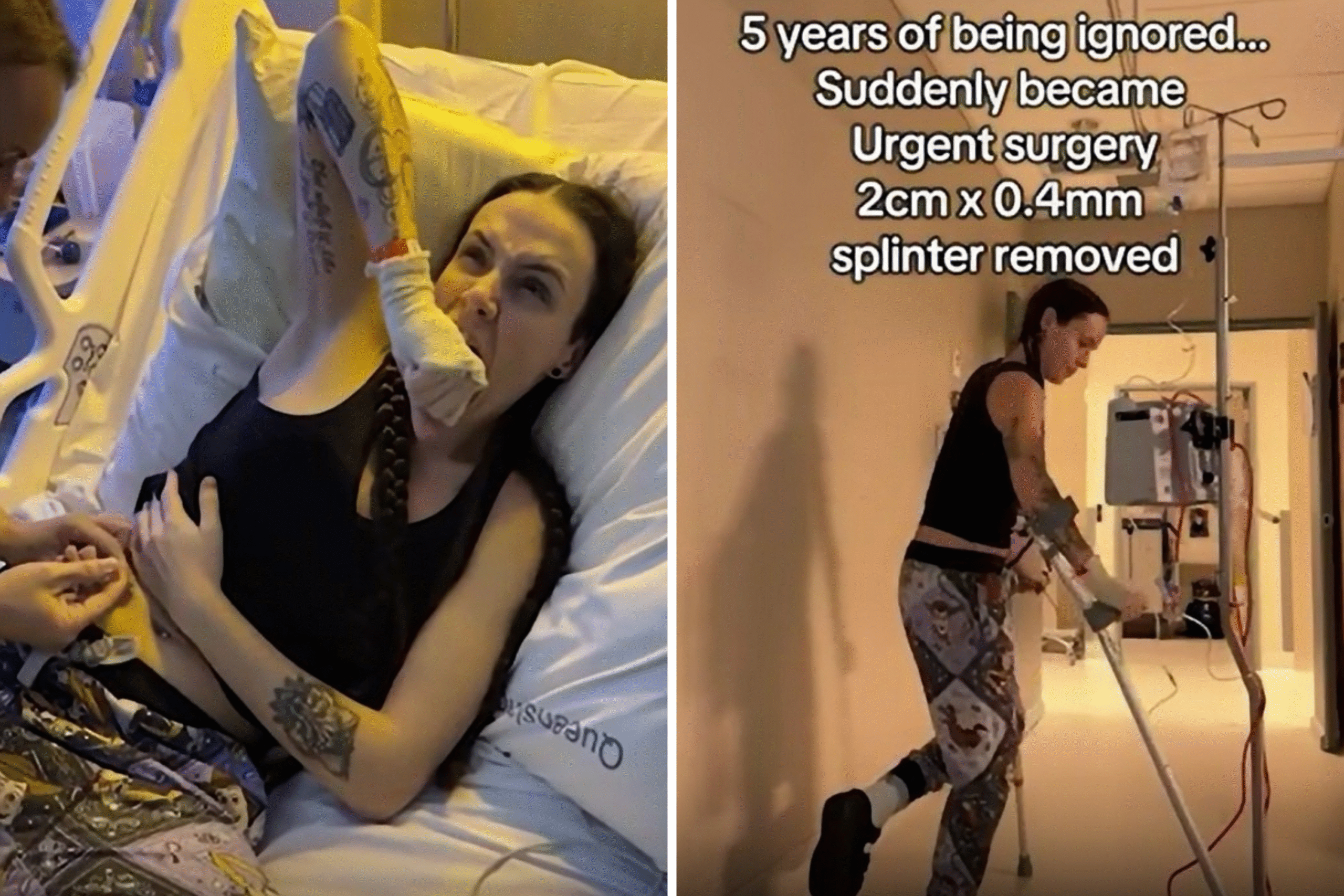 Doctors Said Not to Worry About a Splinter—Then Devastating Symptoms Began 1 billie bedser scaled