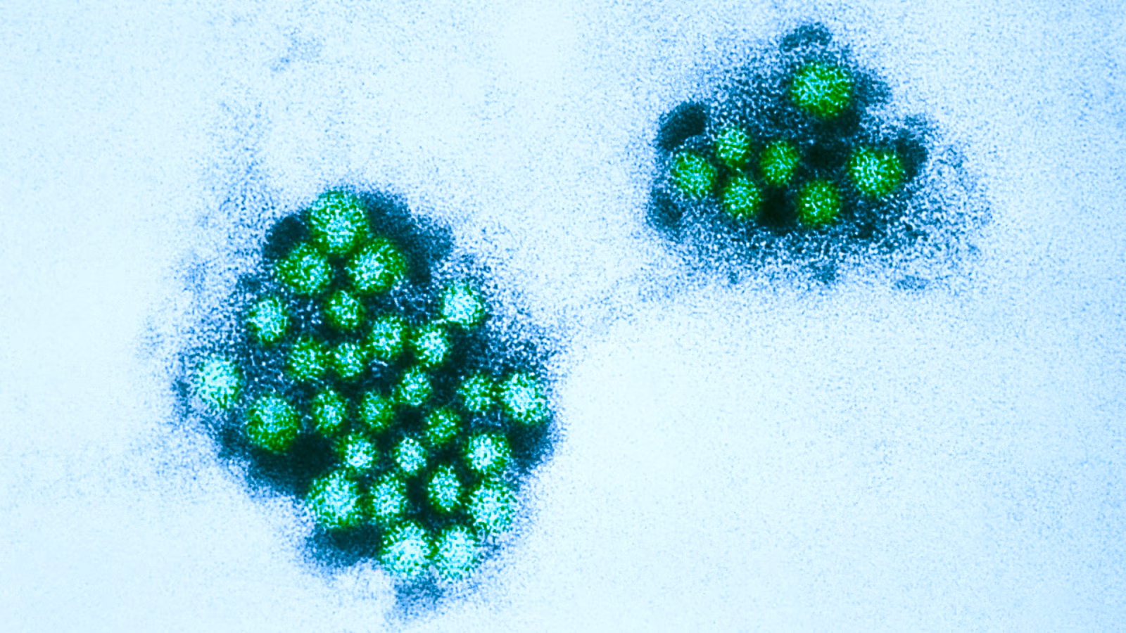 norovirus-gty-er-251217_1766000222331_hpMain_16x9.jpg